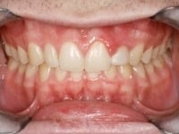 Konig Center for Cosmetic & Comprehensive Dentistry smile photos